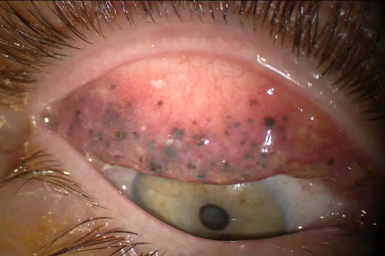 Наращивание ресниц, на которое больно смотреть Наращивание ресниц, на которое больно смотреть