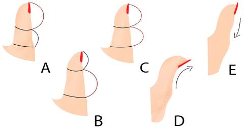 Тест выбери картинку характер человека по форме большого пальца