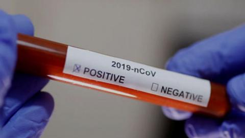 положительный тест на коронавирус