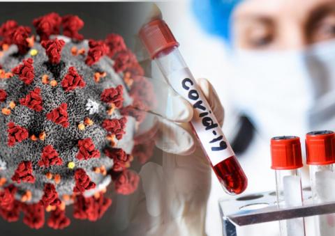 Коллаж: картинка коронавируса, женщина в лаборатории держит колбу с надписью: "Covid-19" Коллаж: коронавирус, колба, женщина, лаборатория