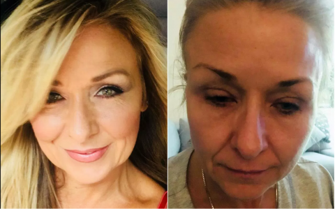 Наращивание ресниц, на которое больно смотреть: жуткий пример в назидание Наращивание ресниц, на которое больно смотреть: жуткий пример в назидание