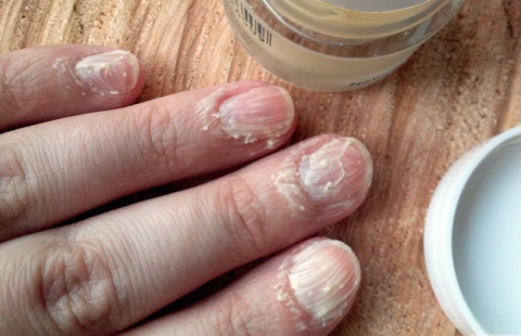  Как спасти ногти после модного маникюра гель-лаком: советы специалистов