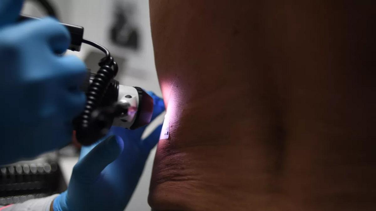 Врач пациент родинка обследование